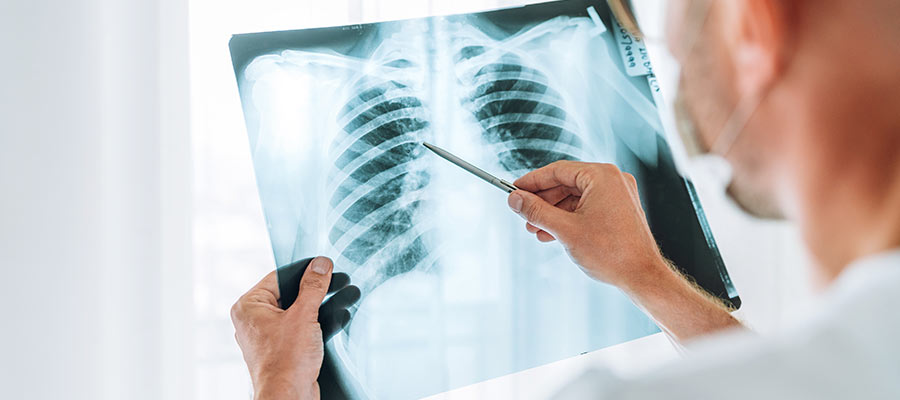 Cost of X-Ray in West New York, NJ Cost of X-Ray in West New York, NJ