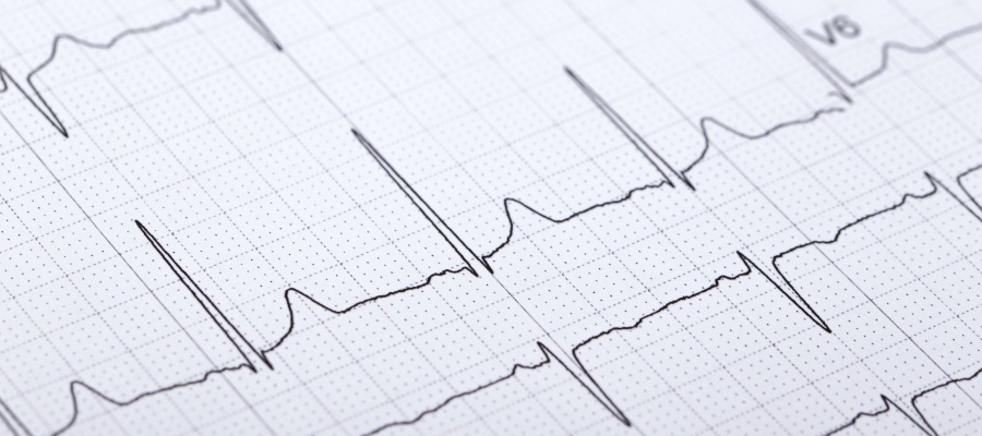 If you’re considering a heart imaging test, understanding the cost of an echocardiogram in West Hudson, NJ—typically ranging from $220 to $1,800 depending on the type of exam and coverage—is an important part of planning your care. At Advanced Magnetic Imaging & Open MRI, patients benefit from advanced diagnostic technology, transparent pricing, and support in navigating insurance coverage.