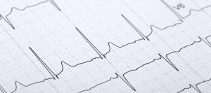 If you’re considering a heart imaging test, understanding the cost of an echocardiogram in West Hudson, NJ—typically ranging from $220 to $1,800 depending on the type of exam and coverage—is an important part of planning your care. At Advanced Magnetic Imaging & Open MRI, patients benefit from advanced diagnostic technology, transparent pricing, and support in navigating insurance coverage.