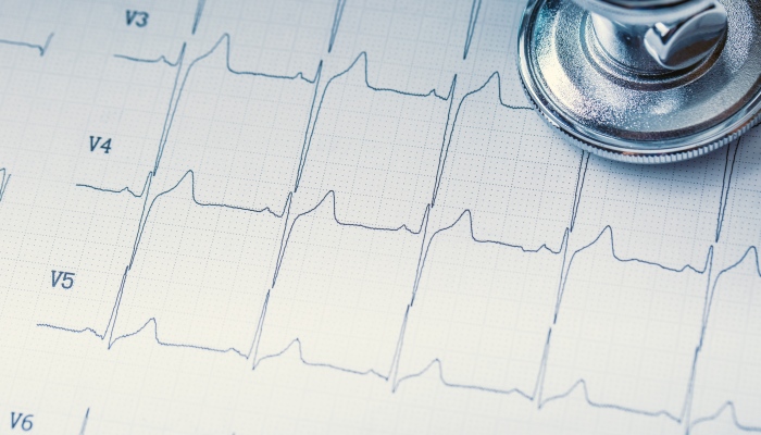 If you’re looking for a reliable and experienced provider for an echocardiogram in West Hudson, NJ, Advanced Open MRI is a trusted choice for high-quality cardiac imaging. With convenient locations and a team of experienced radiologists, patients can expect accurate diagnostics, comfortable care, and efficient service