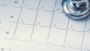 If you’re looking for a reliable and experienced provider for an echocardiogram in West Hudson, NJ, Advanced Open MRI is a trusted choice for high-quality cardiac imaging. With convenient locations and a team of experienced radiologists, patients can expect accurate diagnostics, comfortable care, and efficient service