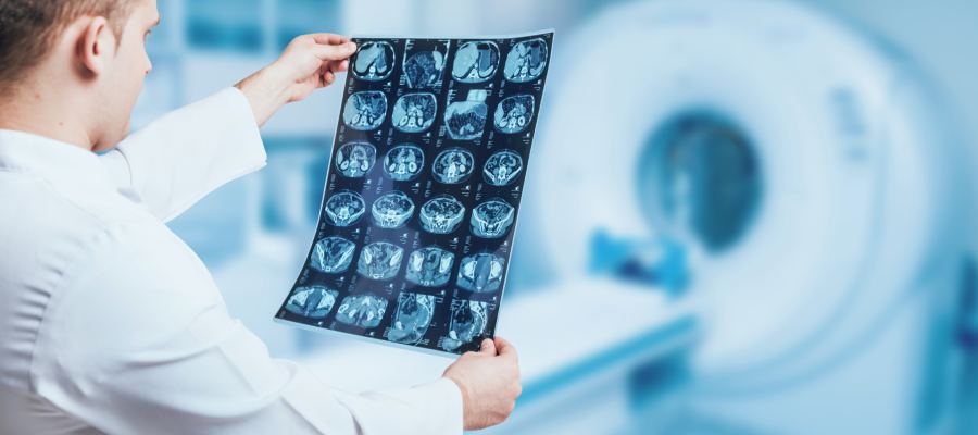 Advanced NeuroQuant Brain MRI Analysis in West New York and Kearny, NJ