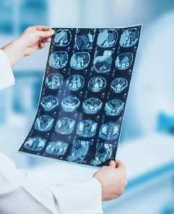 NeuroQuant in West New York, and Kearny, NJ